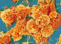 células de cáncer de colón