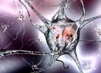 Ilustración de neuronas afectadas por la enfermedad de Parkinson y sus cambios neurológicos.