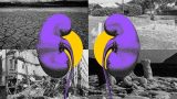 Fotoarte que muestra un par de riñones de color morado frente a un escenario árido y con falta de agua