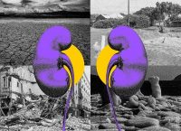 Fotoarte que muestra un par de riñones de color morado frente a un escenario árido y con falta de agua