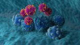 La ilustración que muestra el uso de células T con receptor de antígeno quimérico (CAR) (rosa) para tratar el cáncer de páncreas (azul). (Foto: Getty Images)
