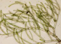 Visualización de microalgas en microscopio